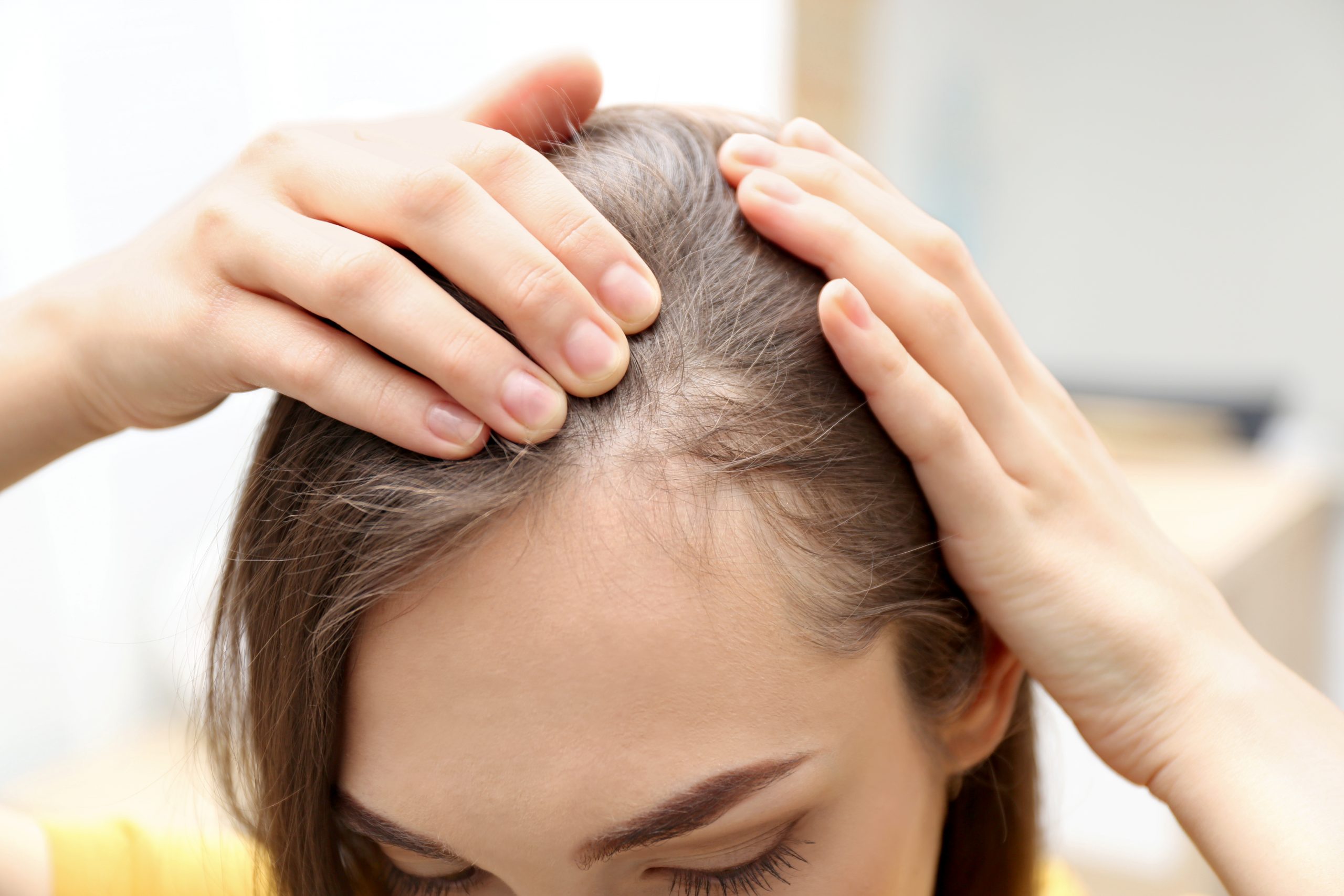 Solutions for women's hair loss can be extensive